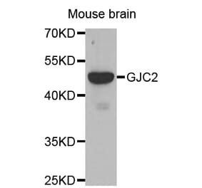 Western blot - GJC2 antibody from Signalway Antibody (38478) - Antibodies.com