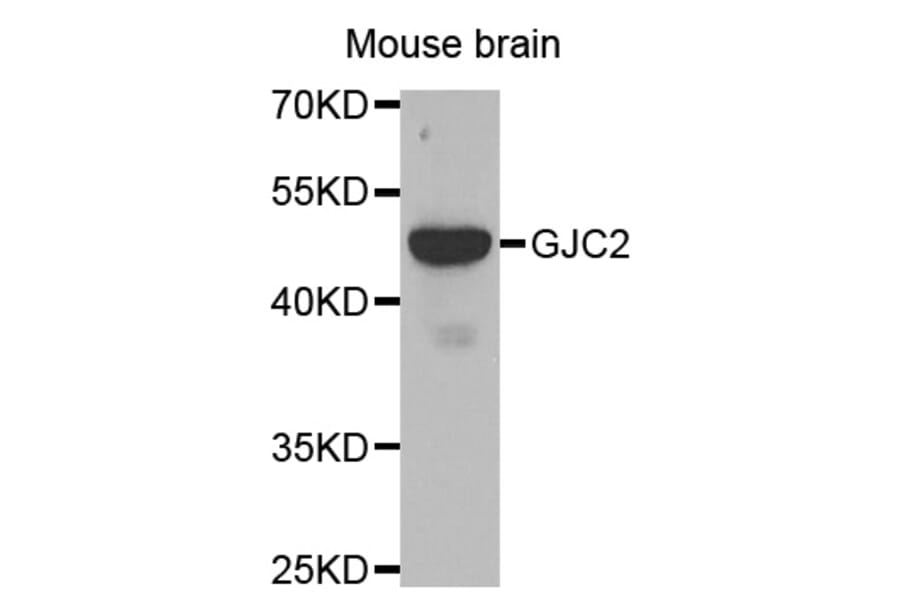 Western blot - GJC2 antibody from Signalway Antibody (38478) - Antibodies.com