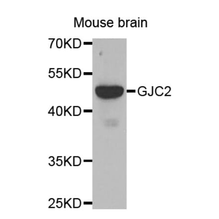 Western blot - GJC2 antibody from Signalway Antibody (38478) - Antibodies.com