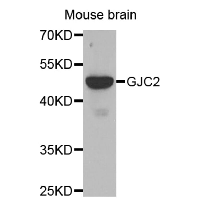 Western blot - GJC2 antibody from Signalway Antibody (38478) - Antibodies.com