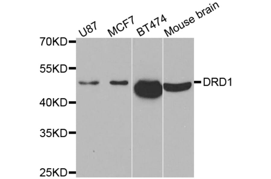 Western blot - DRD1 antibody from Signalway Antibody (38482) - Antibodies.com