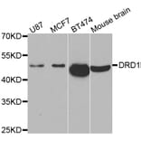 Western blot - DRD1 antibody from Signalway Antibody (38482) - Antibodies.com