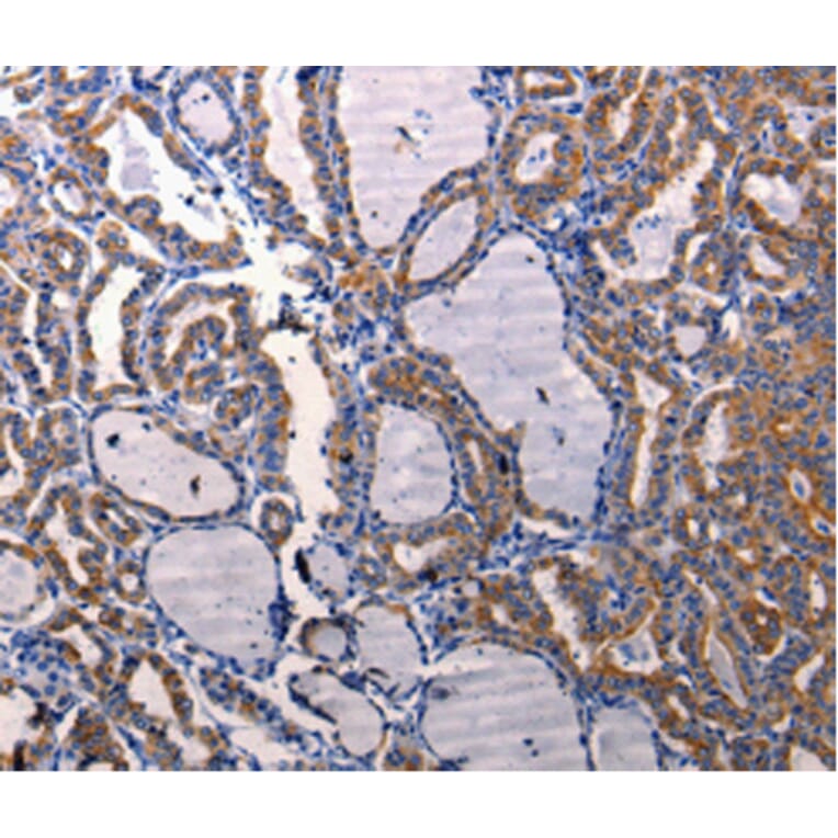 Immunohistochemistry - DRD1 antibody from Signalway Antibody (38482) - Antibodies.com