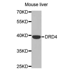 Western blot - DRD4 antibody from Signalway Antibody (38483) - Antibodies.com