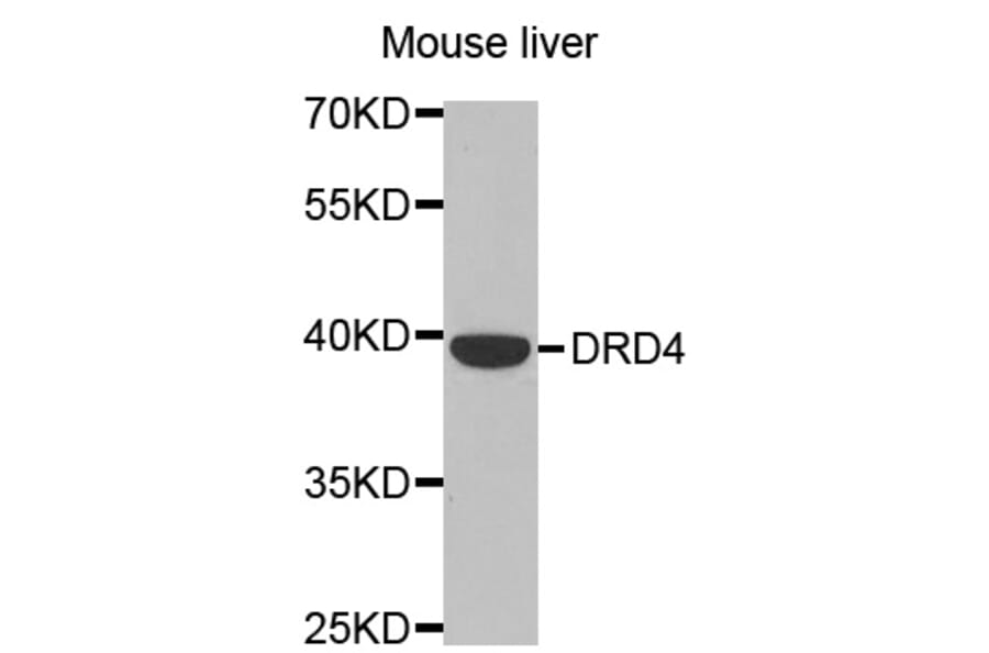 Western blot - DRD4 antibody from Signalway Antibody (38483) - Antibodies.com