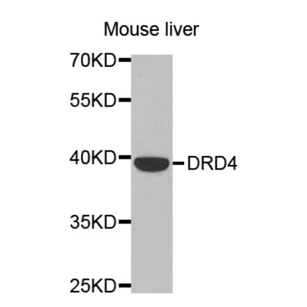 Western blot - DRD4 antibody from Signalway Antibody (38483) - Antibodies.com