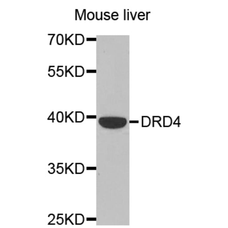 Western blot - DRD4 antibody from Signalway Antibody (38483) - Antibodies.com