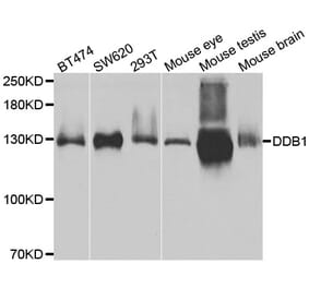 Western blot - DDB1 antibody from Signalway Antibody (38485) - Antibodies.com