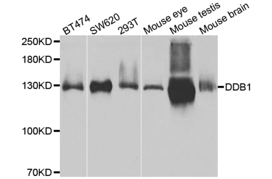 Western blot - DDB1 antibody from Signalway Antibody (38485) - Antibodies.com