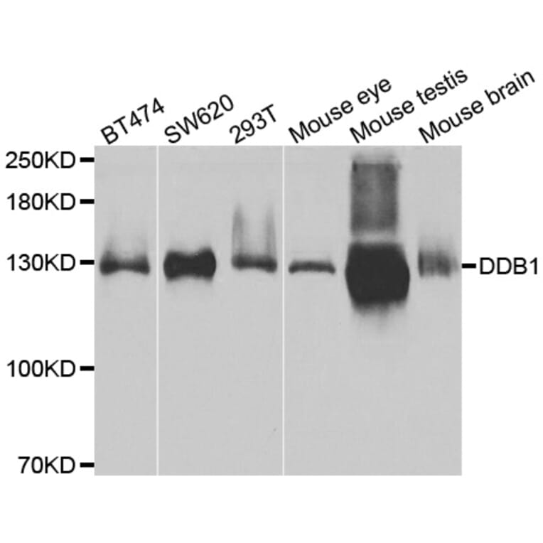 Western blot - DDB1 antibody from Signalway Antibody (38485) - Antibodies.com