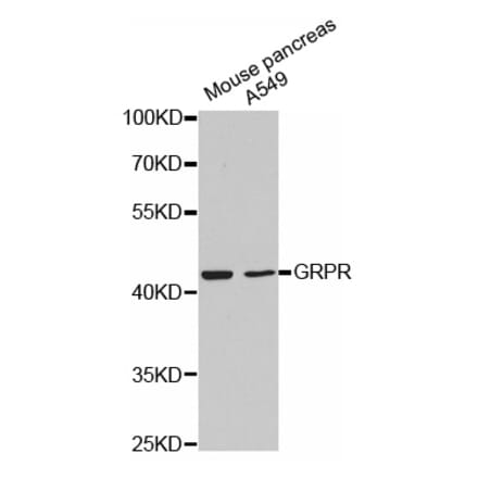 Western blot - GRPR antibody from Signalway Antibody (38503) - Antibodies.com