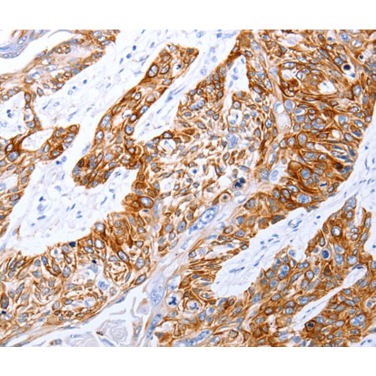 Immunohistochemistry - GRPR antibody from Signalway Antibody (38503) - Antibodies.com