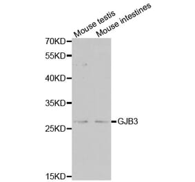 Western blot - GJB3 antibody from Signalway Antibody (38505) - Antibodies.com