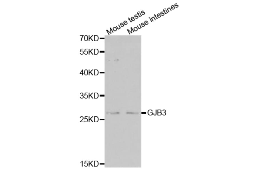 Western blot - GJB3 antibody from Signalway Antibody (38505) - Antibodies.com