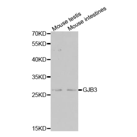 Western blot - GJB3 antibody from Signalway Antibody (38505) - Antibodies.com