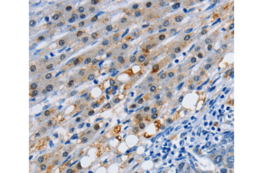 Immunohistochemistry - GJB3 antibody from Signalway Antibody (38505) - Antibodies.com