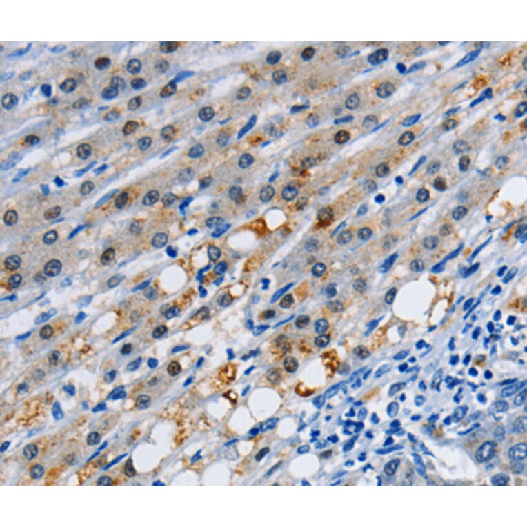 Immunohistochemistry - GJB3 antibody from Signalway Antibody (38505) - Antibodies.com