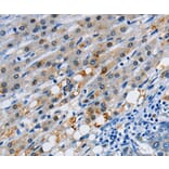 Immunohistochemistry - GJB3 antibody from Signalway Antibody (38505) - Antibodies.com
