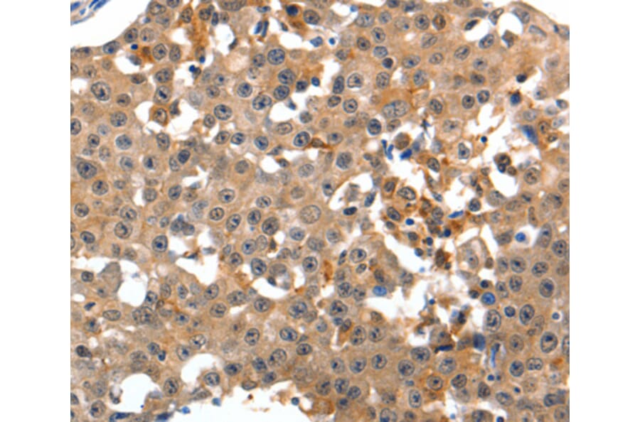 Immunohistochemistry - GRM1 antibody from Signalway Antibody (38510) - Antibodies.com