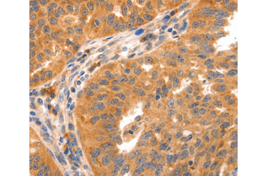 Immunohistochemistry - GRM8 antibody from Signalway Antibody (38511) - Antibodies.com