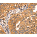 Immunohistochemistry - GRM8 antibody from Signalway Antibody (38511) - Antibodies.com