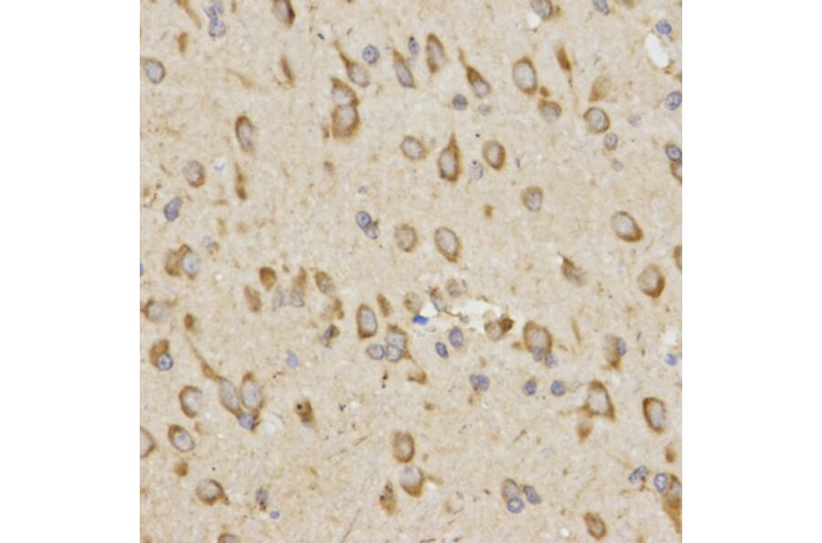 Immunohistochemistry - GRM8 antibody from Signalway Antibody (38511) - Antibodies.com
