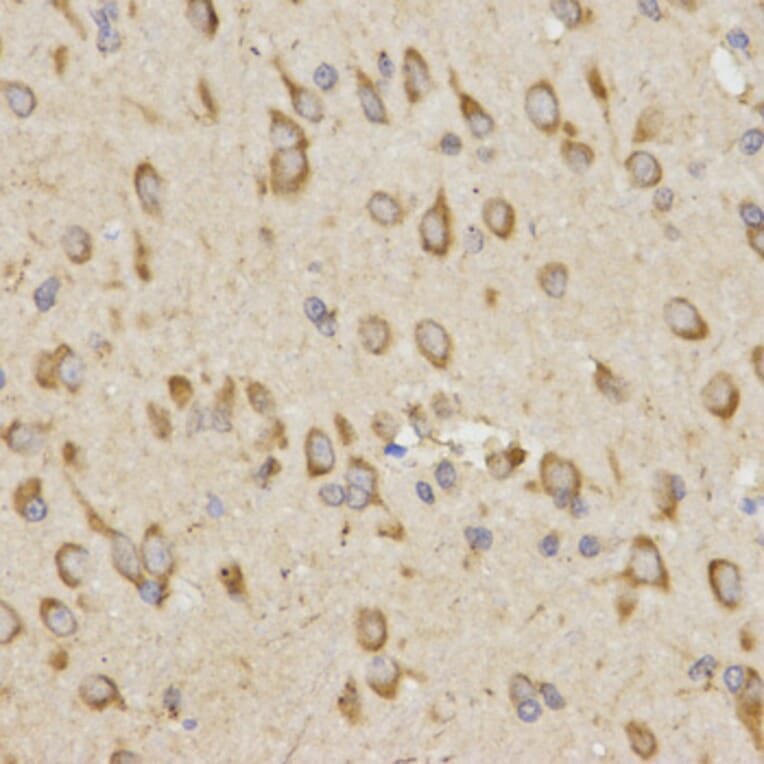 Immunohistochemistry - GRM8 antibody from Signalway Antibody (38511) - Antibodies.com