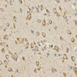 Immunohistochemistry - GRM8 antibody from Signalway Antibody (38511) - Antibodies.com