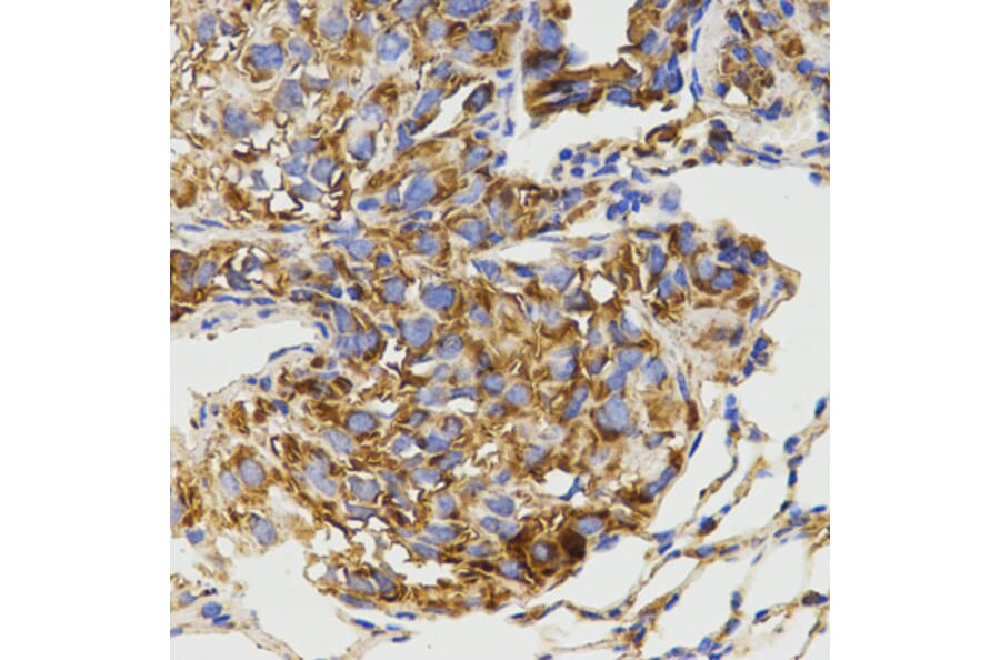 Immunohistochemistry - GRM8 antibody from Signalway Antibody (38511) - Antibodies.com