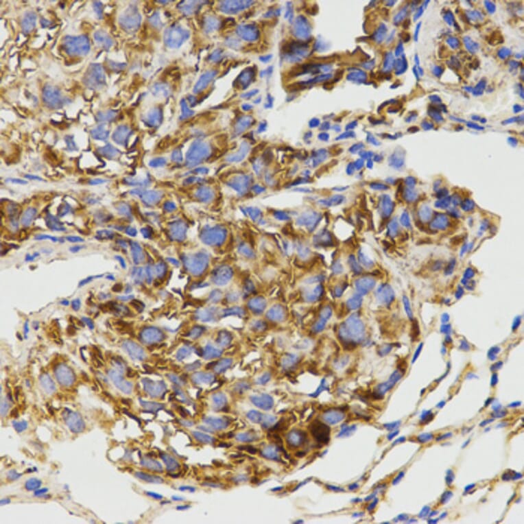 Immunohistochemistry - GRM8 antibody from Signalway Antibody (38511) - Antibodies.com
