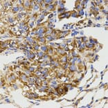 Immunohistochemistry - GRM8 antibody from Signalway Antibody (38511) - Antibodies.com