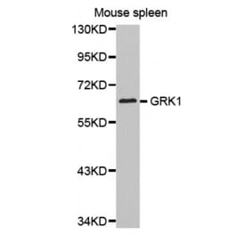 Western blot - GRK1 antibody from Signalway Antibody (38512) - Antibodies.com