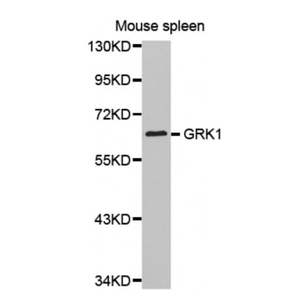 Western blot - GRK1 antibody from Signalway Antibody (38512) - Antibodies.com