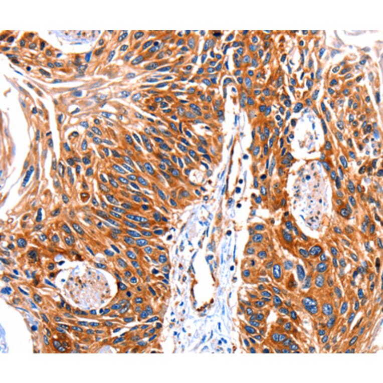 Immunohistochemistry - GRK1 antibody from Signalway Antibody (38512) - Antibodies.com