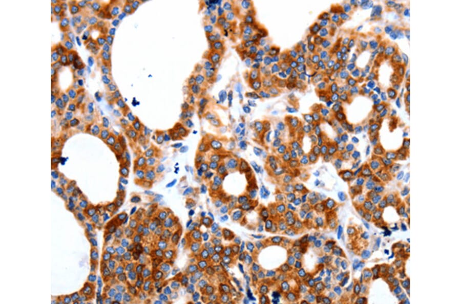 Immunohistochemistry - HCN1 antibody from Signalway Antibody (38515) - Antibodies.com