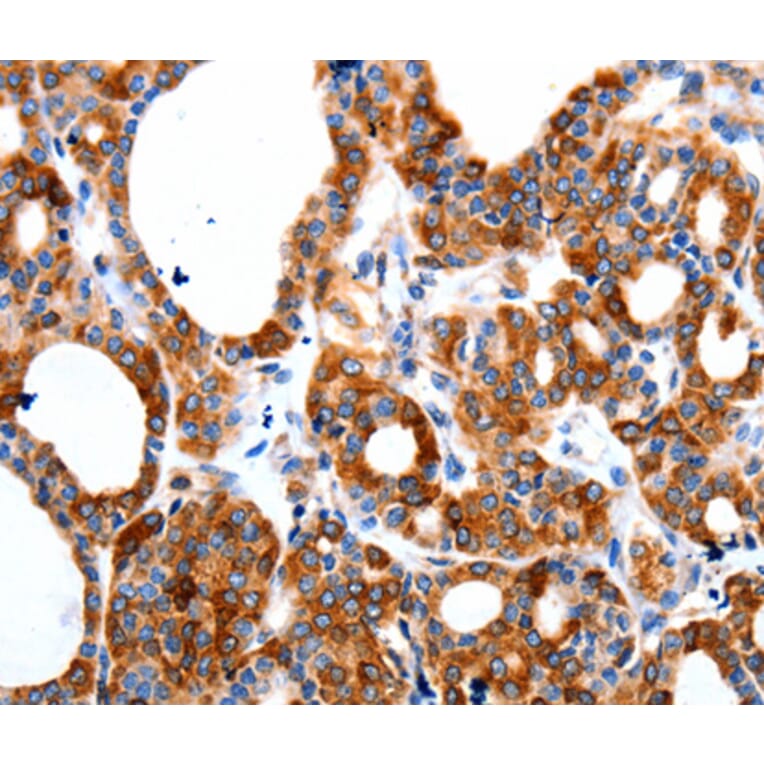 Immunohistochemistry - HCN1 antibody from Signalway Antibody (38515) - Antibodies.com