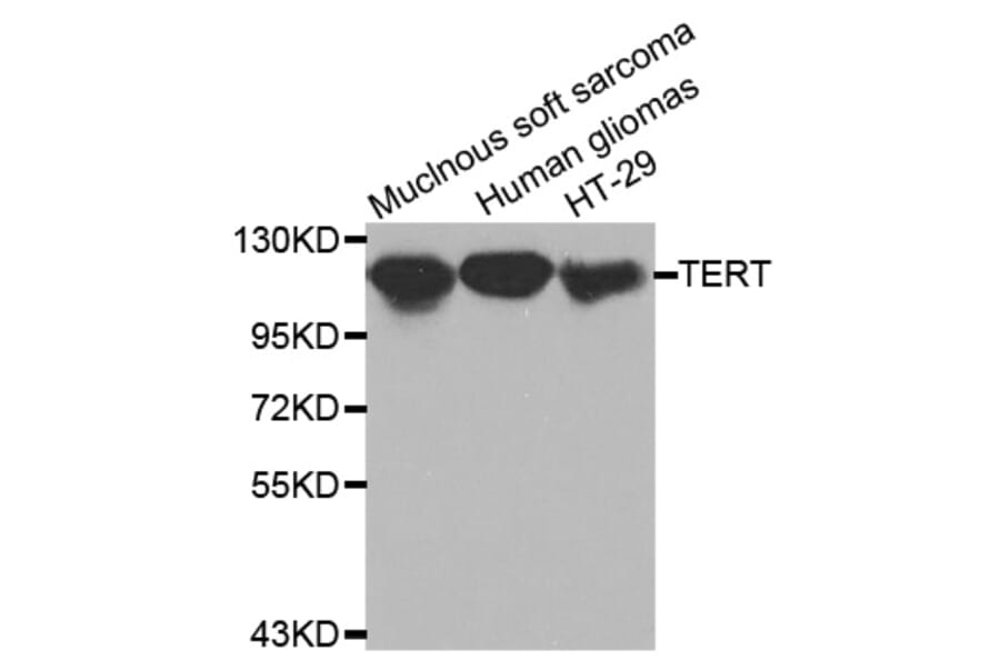 Western blot - TERT antibody from Signalway Antibody (38520) - Antibodies.com