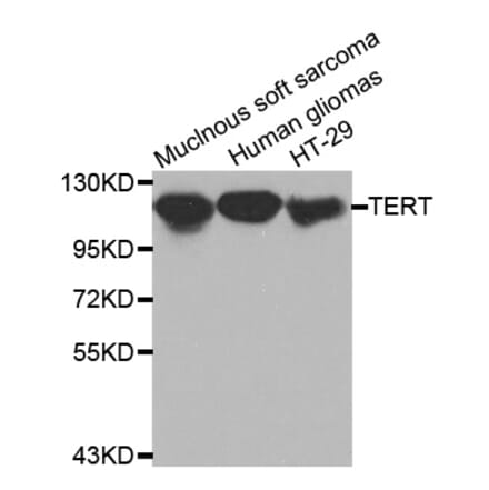 Western blot - TERT antibody from Signalway Antibody (38520) - Antibodies.com