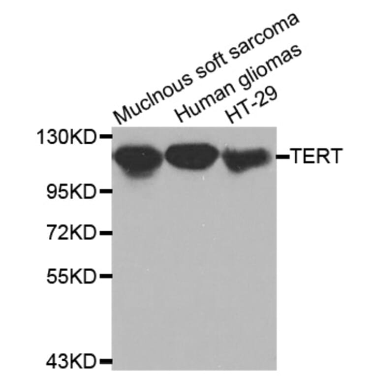 Western blot - TERT antibody from Signalway Antibody (38520) - Antibodies.com