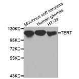Western blot - TERT antibody from Signalway Antibody (38520) - Antibodies.com