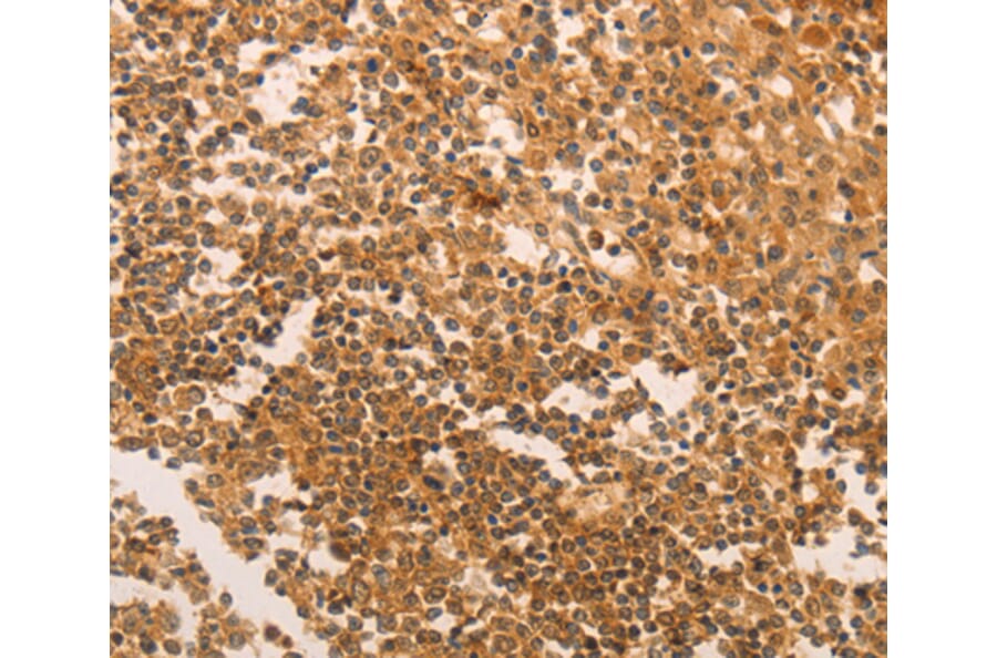Immunohistochemistry - TERT antibody from Signalway Antibody (38520) - Antibodies.com