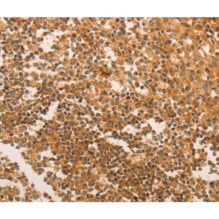 Immunohistochemistry - TERT antibody from Signalway Antibody (38520) - Antibodies.com