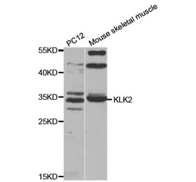 Western blot - KLK2 antibody from Signalway Antibody (38527) - Antibodies.com