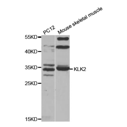 Western blot - KLK2 antibody from Signalway Antibody (38527) - Antibodies.com