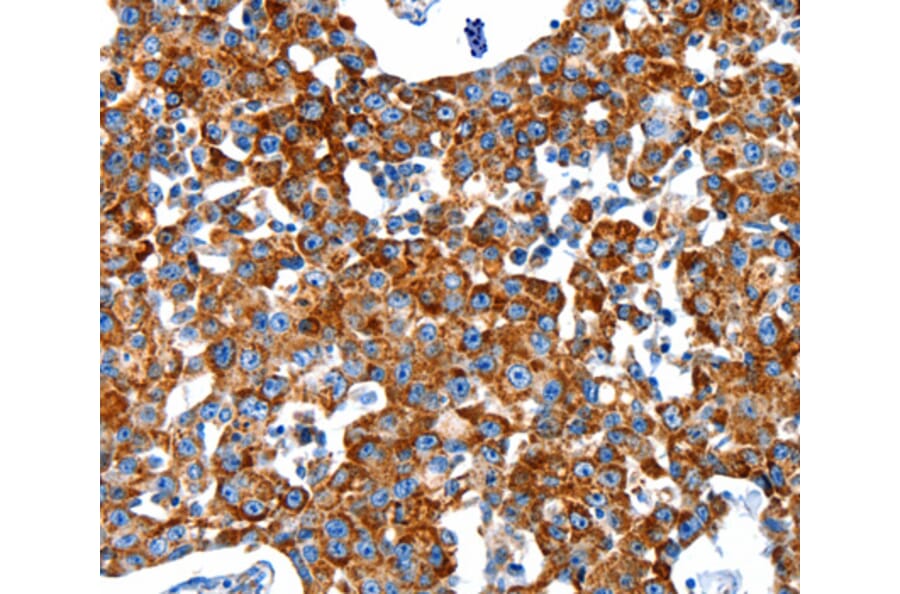 Immunohistochemistry - KLK2 antibody from Signalway Antibody (38527) - Antibodies.com
