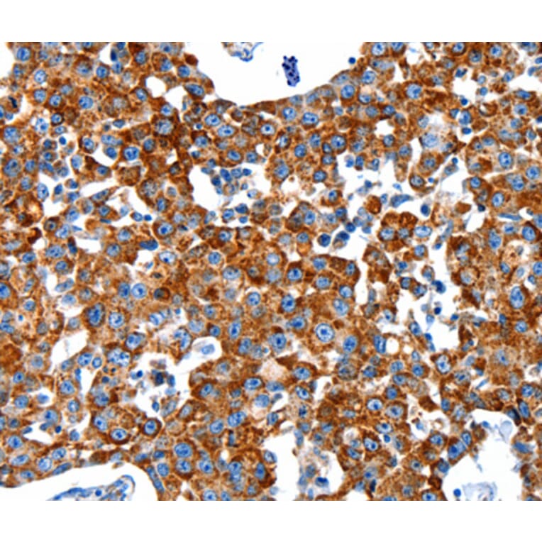 Immunohistochemistry - KLK2 antibody from Signalway Antibody (38527) - Antibodies.com
