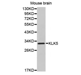 Western blot - KLK5 antibody from Signalway Antibody (38528) - Antibodies.com