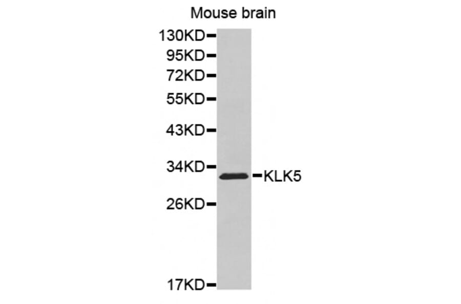 Western blot - KLK5 antibody from Signalway Antibody (38528) - Antibodies.com