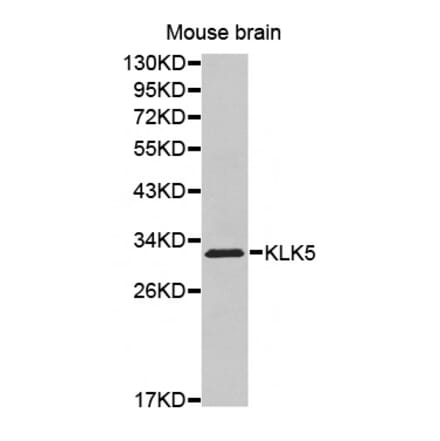 Western blot - KLK5 antibody from Signalway Antibody (38528) - Antibodies.com