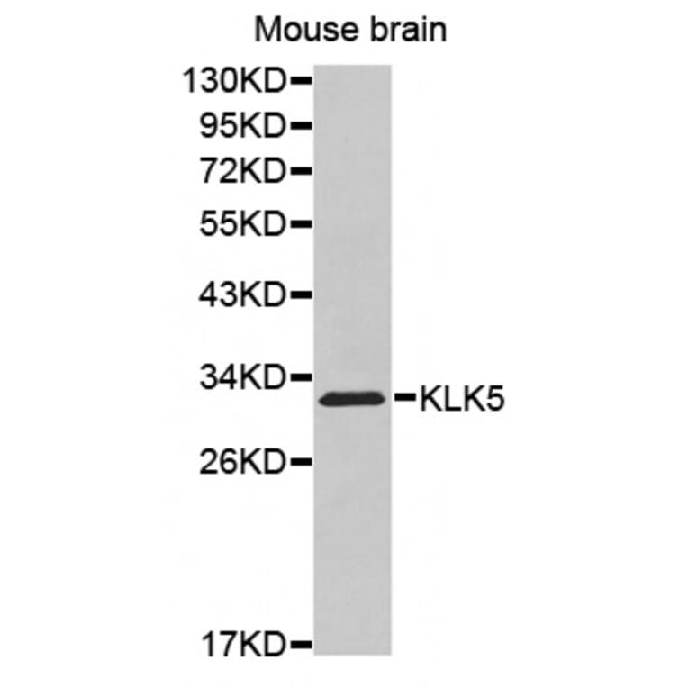 Western blot - KLK5 antibody from Signalway Antibody (38528) - Antibodies.com